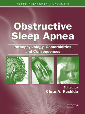 cover image of Obstructive Sleep Apnea